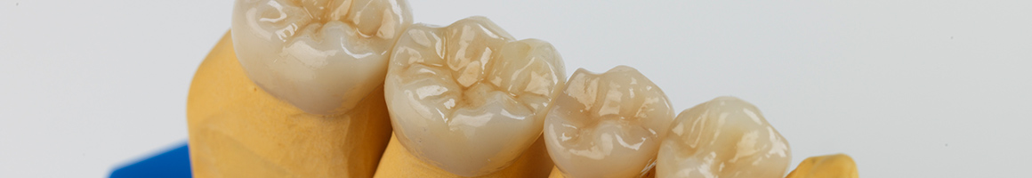 AG_Showcase_Ceramill_Zolid_Uwe_Klingner_042.jpg